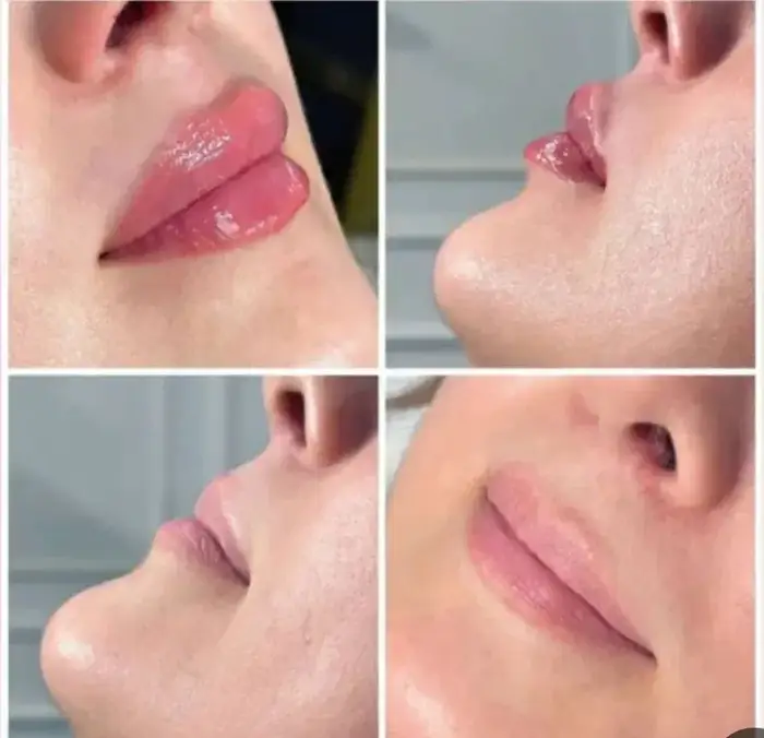 اجاره اتاق 18متری از مطب زیبایی در خیابان معلم تبریز