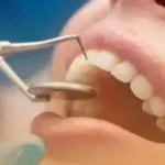 استخدام دستیار دندانپزشک جهت کلینیک در کوهدشت لرستان