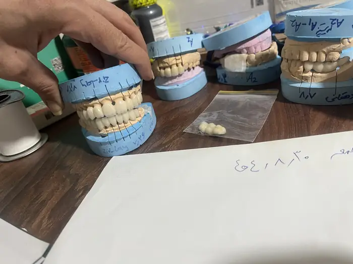 جراح دندانپزشک هستم با سابقه 10ساله آماده همکاری در تهران و کرج