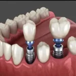 استخدام دندانپزشک به عنوان مسئول فنی و موسس دندانپزشکی در کرمانشاه