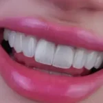 استخدام دندانپزشک جهت مطب فعال در خرم‌آباد