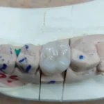 استخدام کارآموز و دندانپزشک جهت همکاری در لابراتوار دندانسازی توماس