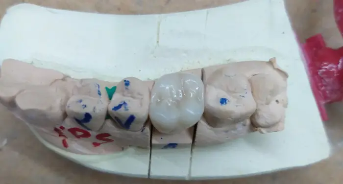 استخدام کارآموز و دندانپزشک جهت همکاری در لابراتوار دندانسازی توماس