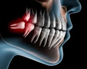 استخدام دستیار دندانپزشک جهت مطب در تهران