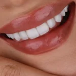 استخدام دستیار دندانپزشک جهت کلینیک در تبریز