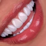 استخدام دستیار دندانپزشک جهت کلینیک در تجریش تهران