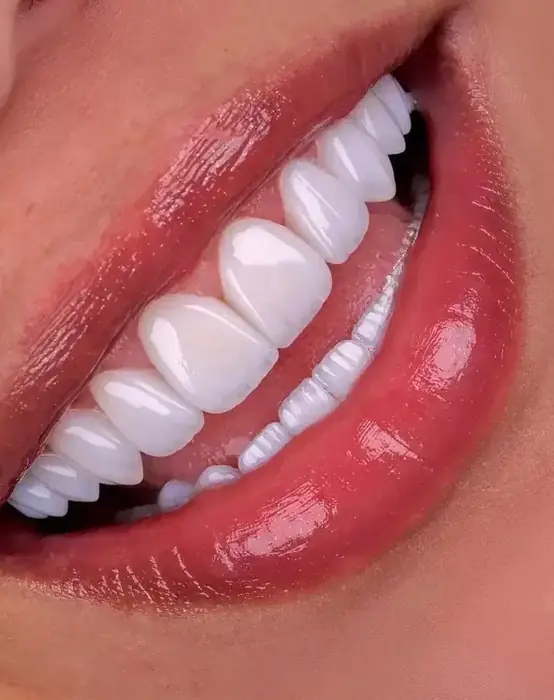 استخدام دستیار دندانپزشک جهت کلینیک در تجریش تهران