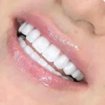 استخدام دندانپزشک زیبایی جهت کلینیک در ولنجک تهران