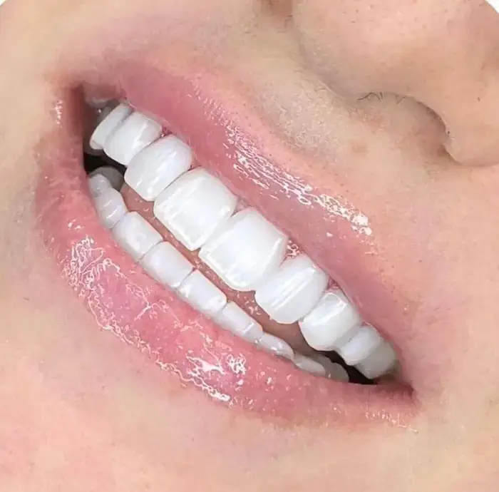 استخدام دندانپزشک زیبایی جهت کلینیک در ولنجک تهران