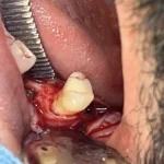 جراح دندانپزشک هستم با سابقه 10ساله آماده همکاری در تهران و کرج