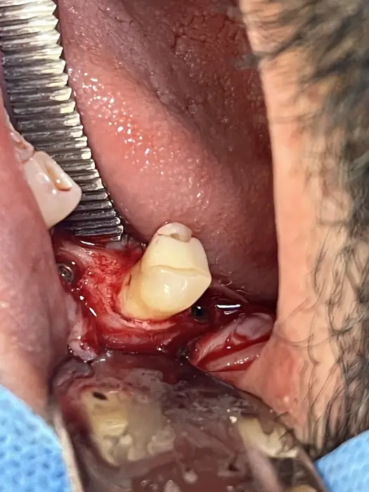 جراح دندانپزشک هستم با سابقه 10ساله آماده همکاری در تهران و کرج