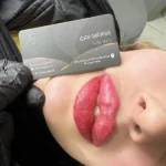 برگزاری ورکشاپ‌های تخصصی آموزش تزریق فیلر و نخ در تهران