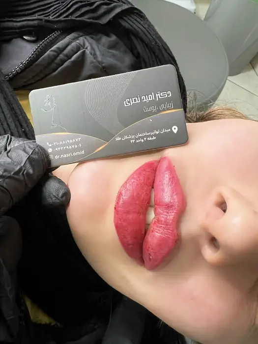 برگزاری ورکشاپ‌های تخصصی آموزش تزریق فیلر و نخ در تهران