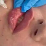 استخدام پزشک عمومی مسلط به کارهای زیبایی جهت مطب در ستارخان تهران