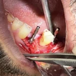 جراح دندانپزشک هستم با سابقه 10ساله آماده همکاری در تهران و کرج