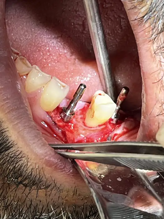 جراح دندانپزشک هستم با سابقه 10ساله آماده همکاری در تهران و کرج