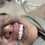 جراح دندانپزشک هستم با سابقه 10ساله آماده همکاری در تهران و کرج