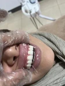 جراح دندانپزشک هستم با سابقه 10ساله آماده همکاری در تهران و کرج