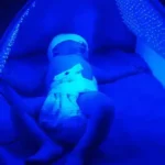 فروش دستگاه فتو تراپی یا زردی نوزاد در خرم‌آباد