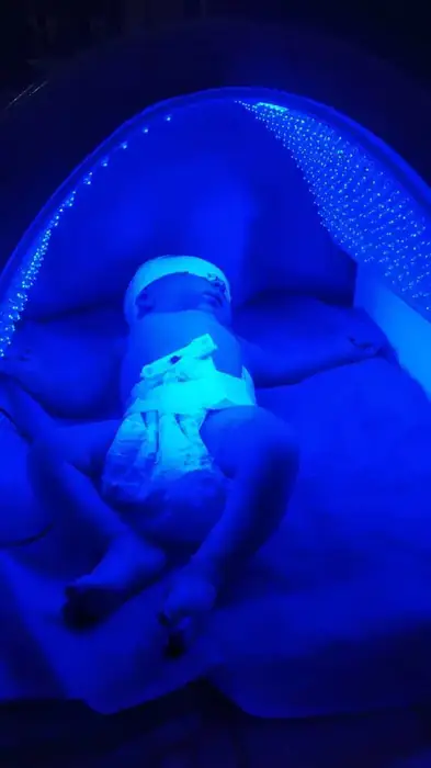 فروش دستگاه فتو تراپی یا زردی نوزاد در خرم‌آباد