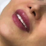 دکتر مسیح افضل هستم مسلط به کلیه خدمات زیبایی در استان اصفهان