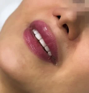 دکتر مسیح افضل هستم مسلط به کلیه خدمات زیبایی در استان اصفهان