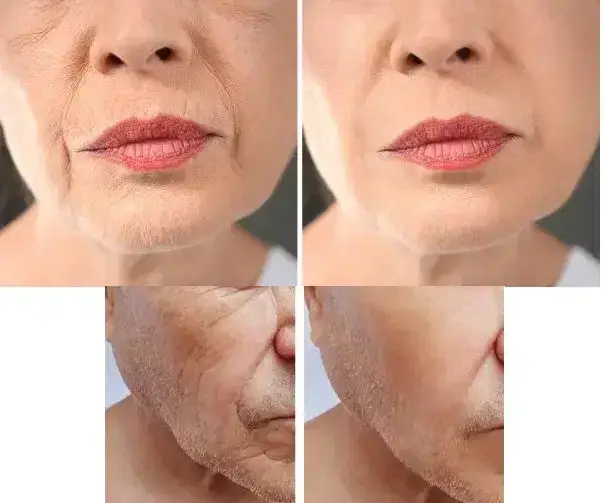 استخدام پزشک زیبایی خانم دارای پروانه جهت مجموعه زیبایی فعال در پونک تهران