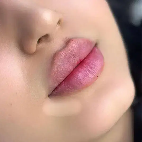 استخدام پزشک عمومی مسلط به امور زیبایی جهت کلینیک در پرند تهران