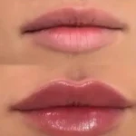 استخدام پزشک به عنوان مسئول فنی کلینیک زیبایی در کاشان
