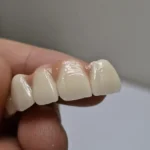 لابراتوار دندانسازی دیجیتال نیکجو آماده ارائه خدمات به دندانپزشکان سراسر کشور