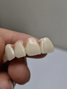 لابراتوار دندانسازی دیجیتال نیکجو آماده ارائه خدمات به دندانپزشکان سراسر کشور