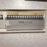 فروش تجهیزات دندانپزشکی در تهران