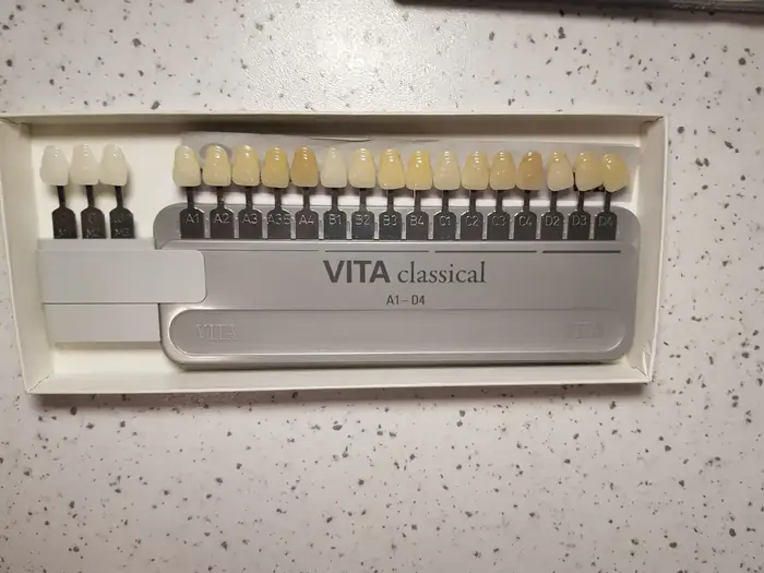 فروش تجهیزات دندانپزشکی در تهران