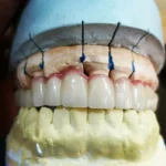 استخدام کارآموز و دندانپزشک جهت همکاری در لابراتوار دندانسازی توماس