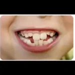 استخدام دستیار دندانپزشک مسلط به ارتودنسی جهت کلینیک در شهریار