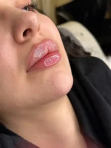 دعوت به همکاری از پزشک زیبایی دارای پروانه جهت مجموعه زیبایی در تبریز