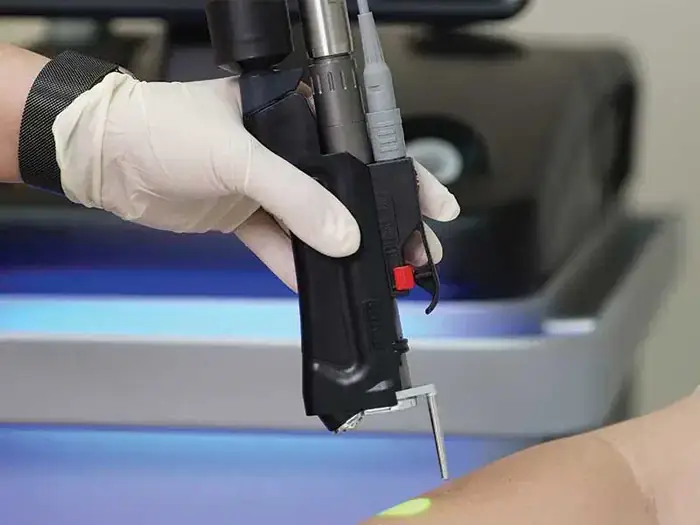 استخدام اپراتور لیزر جهت مطب در اصفهان