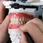 استخدام ثابت کار دندانسازی جهت کلینیک در گرگان