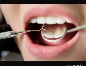 استخدام دستیار دندانپزشک جهت کلینیک در تهران