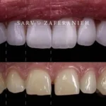 استخدام دستیار دندانپزشک و مسئول پذیرش جهت کلینیک در محمودیه تهران