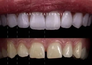 استخدام دستیار دندانپزشک و مسئول پذیرش جهت کلینیک در محمودیه تهران