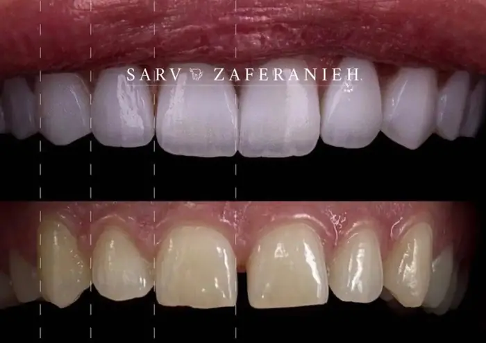 استخدام دستیار دندانپزشک و مسئول پذیرش جهت کلینیک در محمودیه تهران
