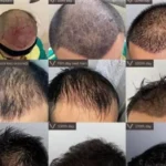 استخدام پزشک متخصص پوست و مو به عنوان مسئول فنی کلینیک زیبایی در تهران