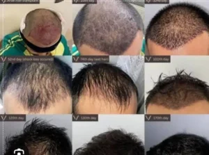 استخدام پزشک متخصص پوست و مو به عنوان مسئول فنی کلینیک زیبایی در تهران