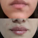 پزشک عمومی هستم مایل به همکاری با کلینیک‌های زیبایی و درمانی در تهران