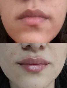 پزشک عمومی هستم مایل به همکاری با کلینیک‌های زیبایی و درمانی در تهران