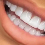 استخدام دندانپزشک دارای پروانه جهت مطب در کرج