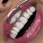 استخدام‌ دستیار دندانپزشک جهت کلینیک در اسلامشهر