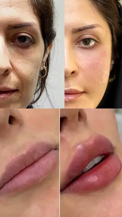نیازمند پزشک زیبایی ترجیحا ساکن غرب تهران