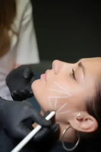 دعوت از پزشک دارای پروانه جهت انجام خدمات زیبایی در تهران